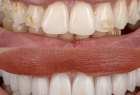 Стоматологическая клиника DENTISTMAN Стоматологическая клиника DENTISTMAN на ул. Голосеевская. Онлайн запись в клинику на сайте Doc.ua (044) 337-07-07