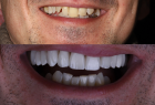 Стоматологическая клиника DENTISTMAN Стоматологическая клиника DENTISTMAN на ул. Голосеевская. Онлайн запись в клинику на сайте Doc.ua (044) 337-07-07