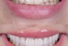 Стоматологическая клиника DENTISTMAN Стоматологическая клиника DENTISTMAN на ул. Голосеевская. Онлайн запись в клинику на сайте Doc.ua (044) 337-07-07