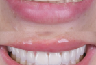Стоматологическая клиника DENTISTMAN Стоматологическая клиника DENTISTMAN на ул. Волынская. Онлайн запись в клинику на сайте Doc.ua (044) 337-07-07