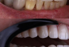 Стоматологическая клиника DENTISTMAN Стоматологическая клиника DENTISTMAN на ул. Голосеевская. Онлайн запись в клинику на сайте Doc.ua (044) 337-07-07