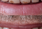 Стоматологическая клиника DENTISTMAN Стоматологическая клиника DENTISTMAN на ул. Голосеевская. Онлайн запись в клинику на сайте Doc.ua (044) 337-07-07