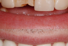 Стоматологическая клиника DENTISTMAN Стоматологическая клиника DENTISTMAN на ул. Голосеевская. Онлайн запись в клинику на сайте Doc.ua (044) 337-07-07