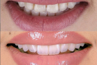 Стоматологическая клиника DENTISTMAN Стоматологическая клиника DENTISTMAN на ул. Голосеевская. Онлайн запись в клинику на сайте Doc.ua (044) 337-07-07